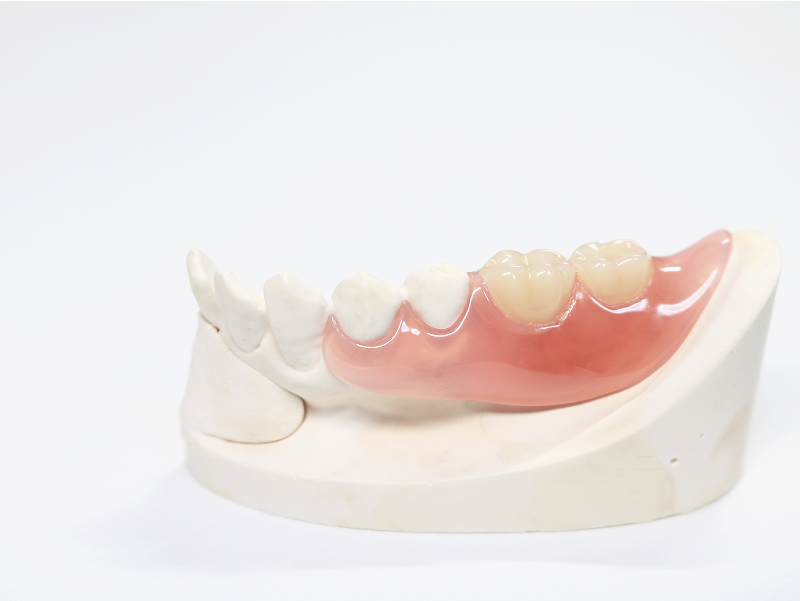 入れ歯